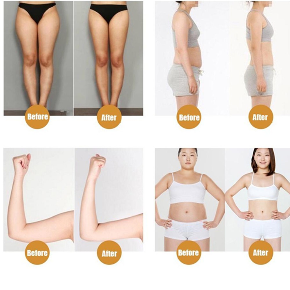 【มีสินค้าพร้อมจัดส่ง】ALIVER แผ่นแปะลดน้ำหนัก 50เม็ด ส่งเสริมการเผาผลาญไขมัน ขจัดสารพิษออกจากร่างกาย แผ่นลดน้ำหนัก - รูปที่ 5