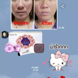 ⚡ถูกที่สุด⚡ขายดีที่สุด ของแท้ส่งตรงจากบริษัท #ครีมโยนิเซ่​ Yonise 🎁มีของแถมทุกกล่อง