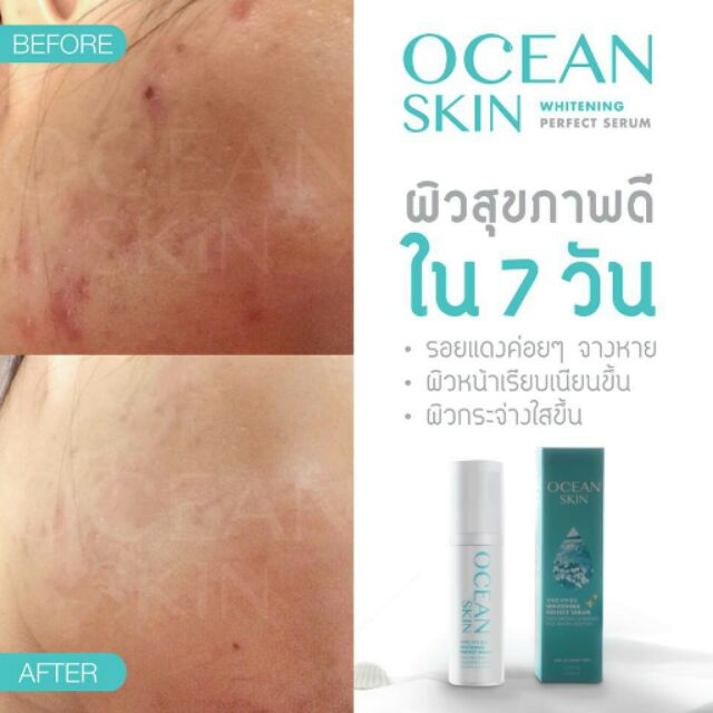 😉Ocean skin Whitening perfect serum 😝