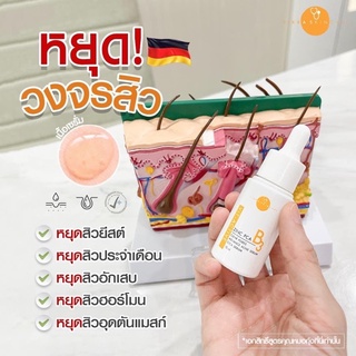 เซรั่มหมอกุ้ง vikkaskincare เซรั่มลดสิว ของแท้ 100%❗️