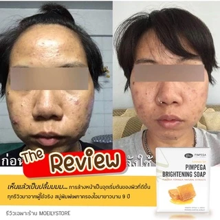 [ส่งไวมาก เปิดขนส่งเอง] สบู่พิมพ์เพกา ลดสิว หน้าสว่างใสอย่างเป็นธรรมชาติ