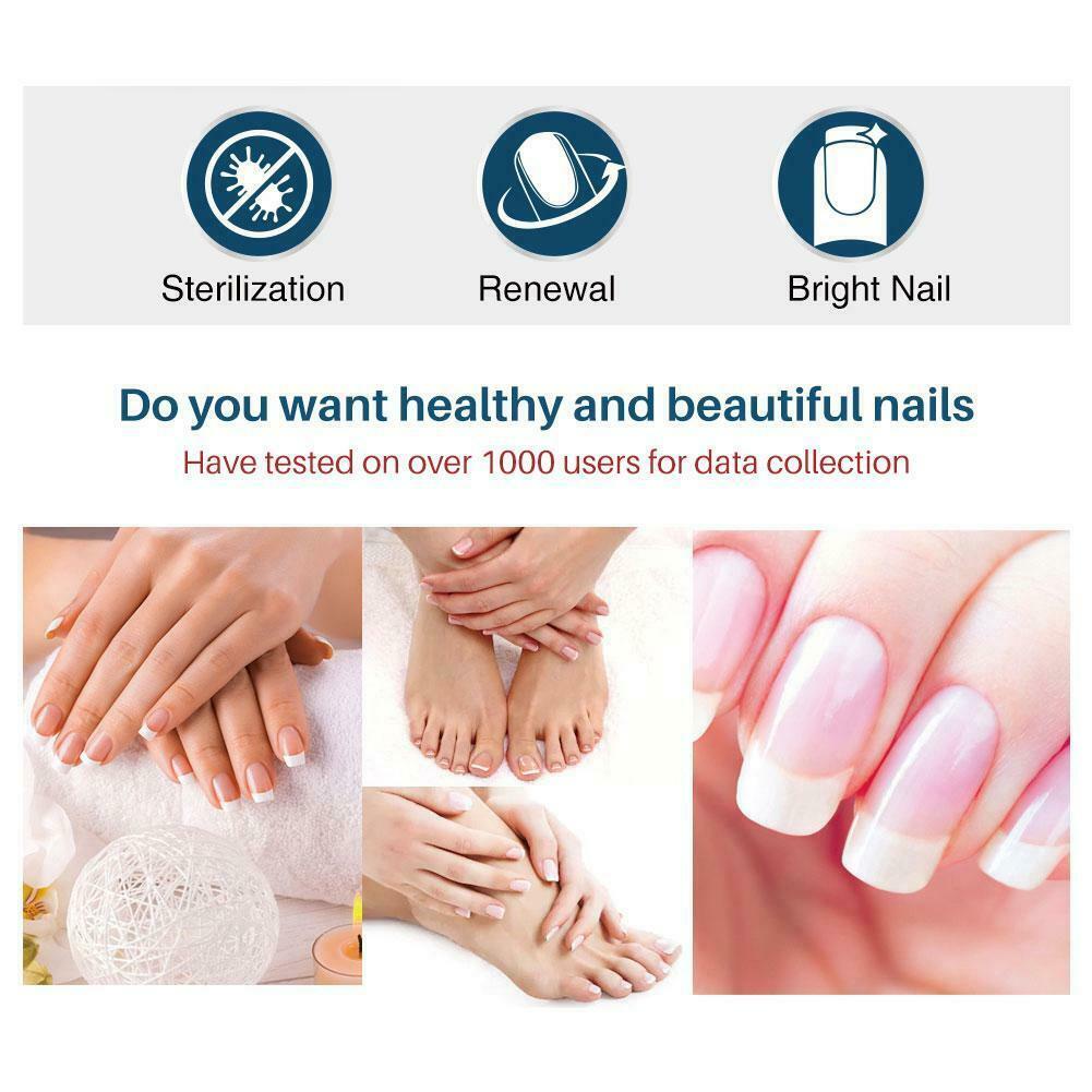 LANTHOME 10ml fungal nail repair nourish fungal nail to anti-infection hand treatment foot G9O6