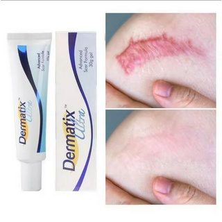 Dermatix Ultra Gel 15g ครีมแผลเป็น เจลซ่อมแซม