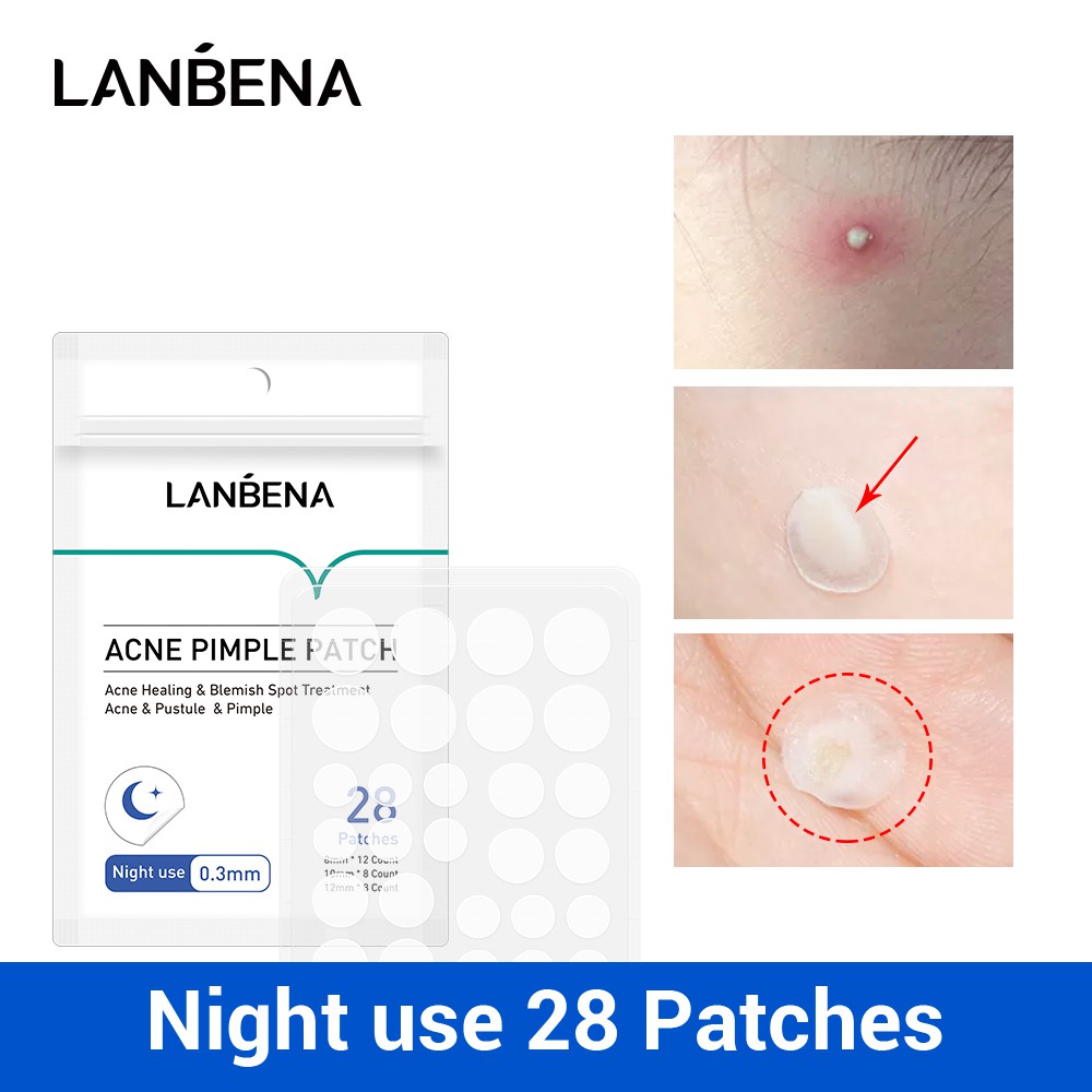 lanbena patch เครื่องมือรักษาสิวฝ้ามาส์กหน้า 28 ชิ้น