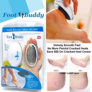 Foot Buddy ที่ขัดส้นเท้า แก้ส้นเท้าแตก เท้าลาย