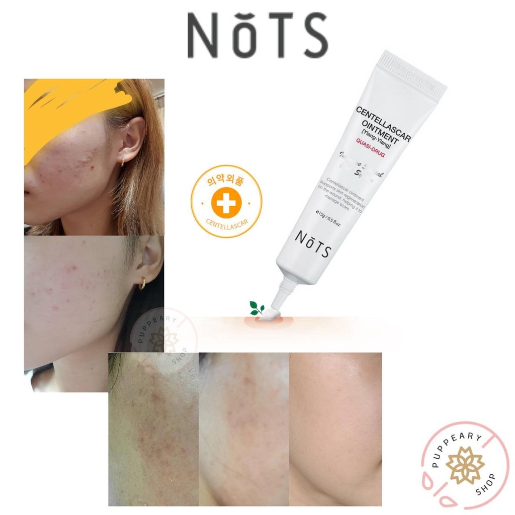 (แท้/พร้อมส่ง) NOTS CENTELLA SCAR OINTMENT [YLANG-YLANG] 15G ครีมรักษารอยสิว