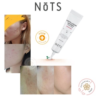 (แท้/พร้อมส่ง) NOTS CENTELLA SCAR OINTMENT [YLANG-YLANG] 15G ครีมรักษารอยสิว