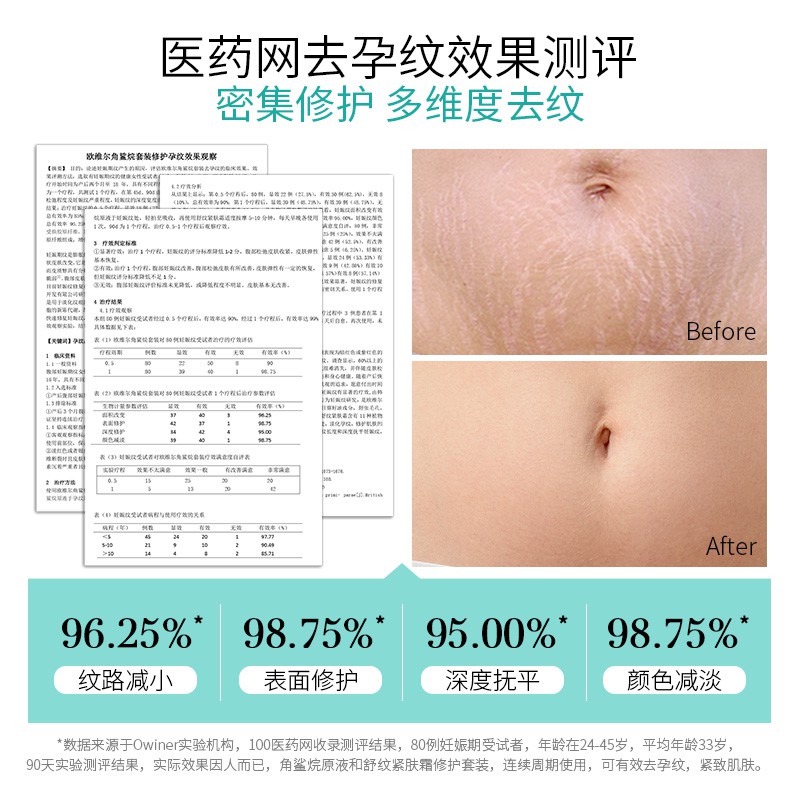 ผลิตภัณฑ์อาบน้ำและดูแลผิวกายowiner Olive Oil Pregnancy Stretch Mark