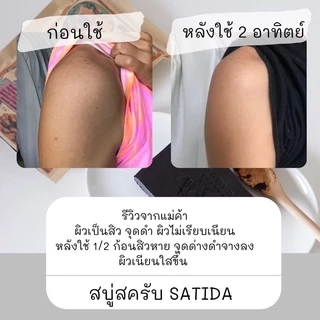 ส่งไว✨สบู่สครับสมุนไพรช็อคโก้บาร์ ขนาด 110 กรัม ผิวเนียนใสแบบ 2 in 1