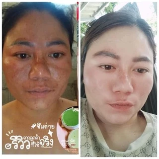 โฉมใหม่‼️ครีมไรยา ครีมริชชี่=ครีมลาน่า LANA เซรั่มมิรา Mira
