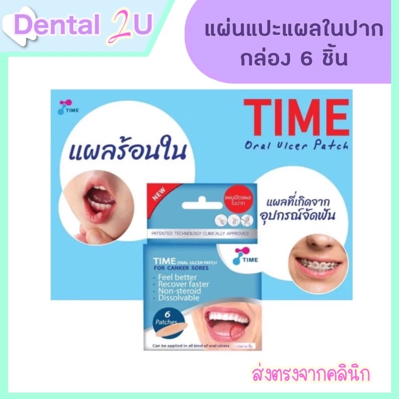 ลด50%ในไลฟ์ 🦷 ถูกสุดๆ ลอตใหม่ TIME Oral Ulcer Patch 1 กล่อง (6 ชิ้น) แผ่นแปะแผลในปาก แผลร้อนใน แผ่นแปะร้อนใน