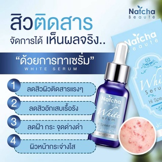 ของแท้!! เซรั่มณัชชา NatchaSerum 30 ml  ลด ฝ้า กระ จุดด่างดำ