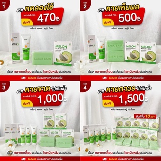 SET ครีมทาเชื้อรา Ultra U อัลตร้ายู x  สบู่ Melon Acne Soap ปราบสิวหลังสวย