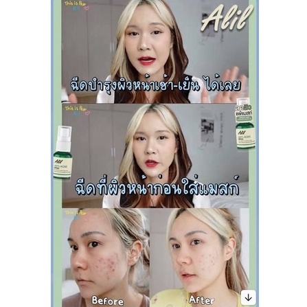 (พร้อมส่ง) Alil Anti-Acne Spray สเปรย์ลดสิว แพ้แมสก์ ปกป้องผิวจากมลภาวะ ...