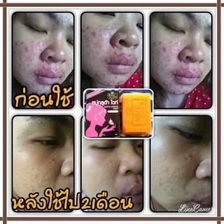 🍊สบู่กลูต้าไวท์ BMK SKINCARE 🍊 ช่วยผลัดเซลล์ผิว เพิ่มความใส✨