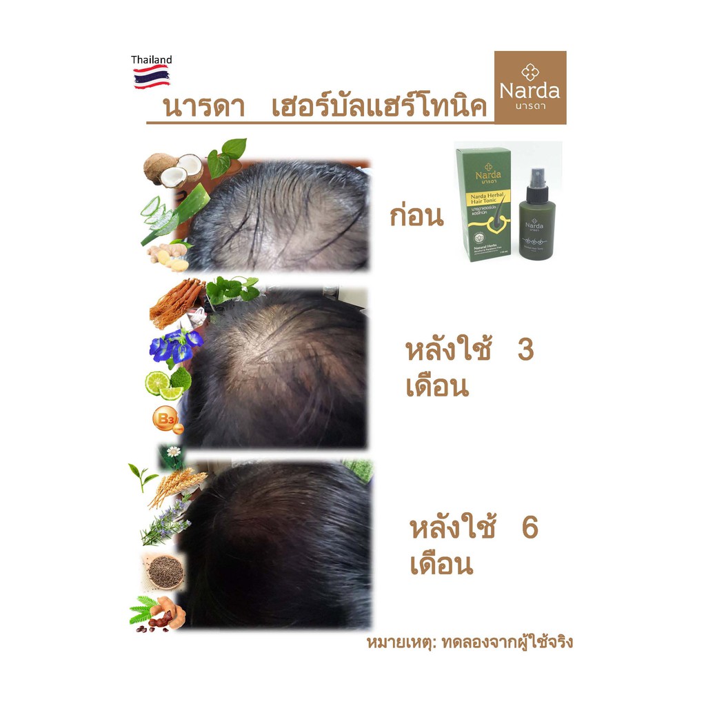 นารดา เฮอร์บัลแฮร์โทคนิค 110ml. ดูแลเส้นผมจากสมุนไพรธรรมชาติ - รูปที่ 6