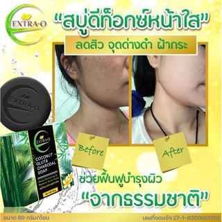 ใหม่!!! สบู่น้ำมันมะพร้าวกลูต้าชาร์โคล Extra-O ขนาด 60 กรัม