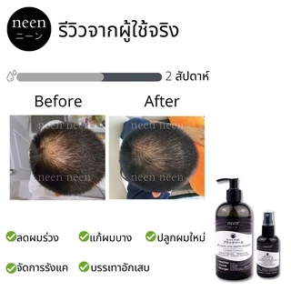 เซรั่มแชมพู ลดผมร่วง เร่งผมใหม่ ปลูกผม ลดคัน ลดรังแค ลดแพ้และอักเสบ neen Anti Hair Loss Serum Shampoo