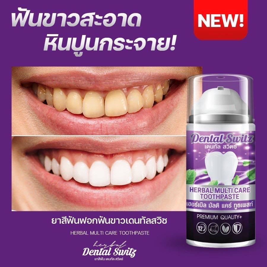 <<1 แถม 1 ของแท้>>  ยาสีฟัน Dental switz เจลฟอกฟันขาว ยาสีฟันฟอกฟันขาว กลิ่นปาก หินปูน ฟอกฟันเองที่บ
