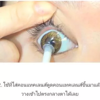 📣 สินค้าราคาถูก ที่คีบ คอนแทคเลนส์ ไม้คีบเลนส์ + ที่ดูดเลนส์ + กล่องใส่อุปกรณ์