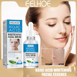 Eelhoe Kojic Acid คอลลาเจนไวท์เทนนิ่งเซรั่ม ควบคุมความมัน ครีมบํารุงผิวหน้า โลชั่นฟอกสี ไนอะซินาไมด์ 5% + สควาเลน เรตินอล 0.5% + HA เซรั่ม กระจ่างใส + ไวท์เทนนิ่ง 30 มล.