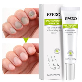 Efero มาสก์เท้าแคลลัส ผิวที่ตายแล้ว ผิวเนินเขา มาสก์เท้า น้ํายาซ่อมแซมเล็บ สีเทา