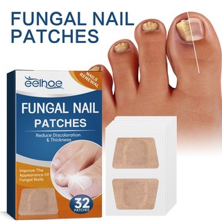 32 Adesivos Para O Cuidado Do Fungo Das Unhas Dos Pés Tratamento Noturno