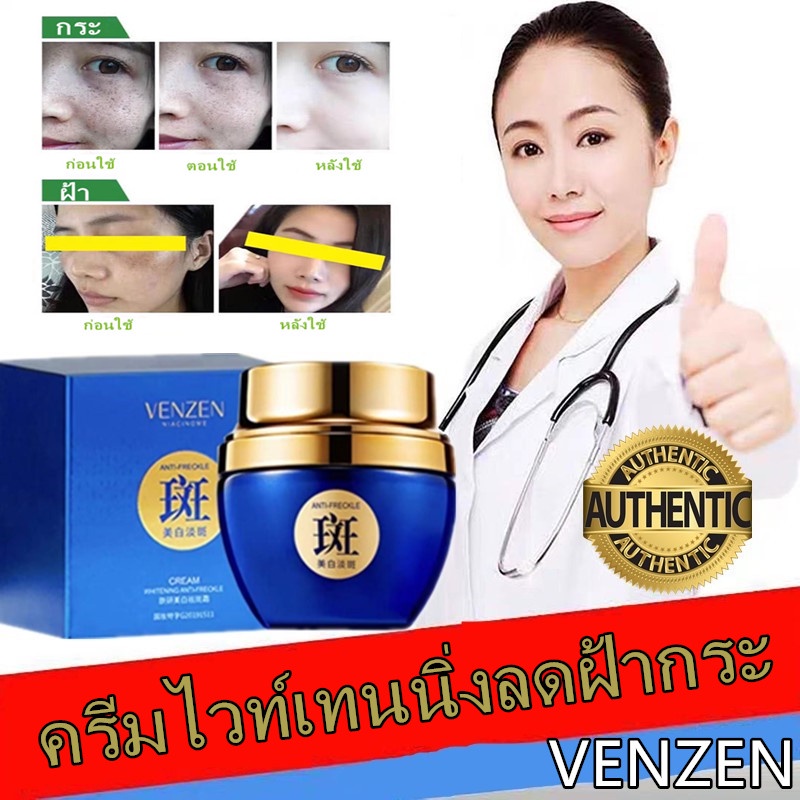 (เห็นผลเร็ว/ของแท้) VENZEN Whitening Anti-Freckle Cream ครีมทาฝ้า ครีมไวท์เทนนิ่ง ลดฝ้า กระ จุดด่างด