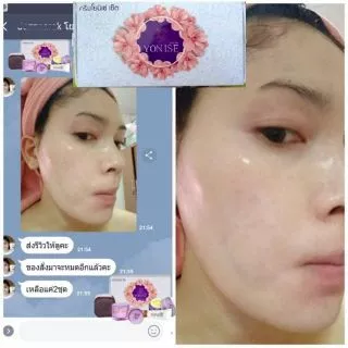 ⚡ถูกที่สุด⚡ขายดีที่สุด ของแท้ส่งตรงจากบริษัท #ครีมโยนิเซ่​ Yonise 🎁มีของแถมทุกกล่อง