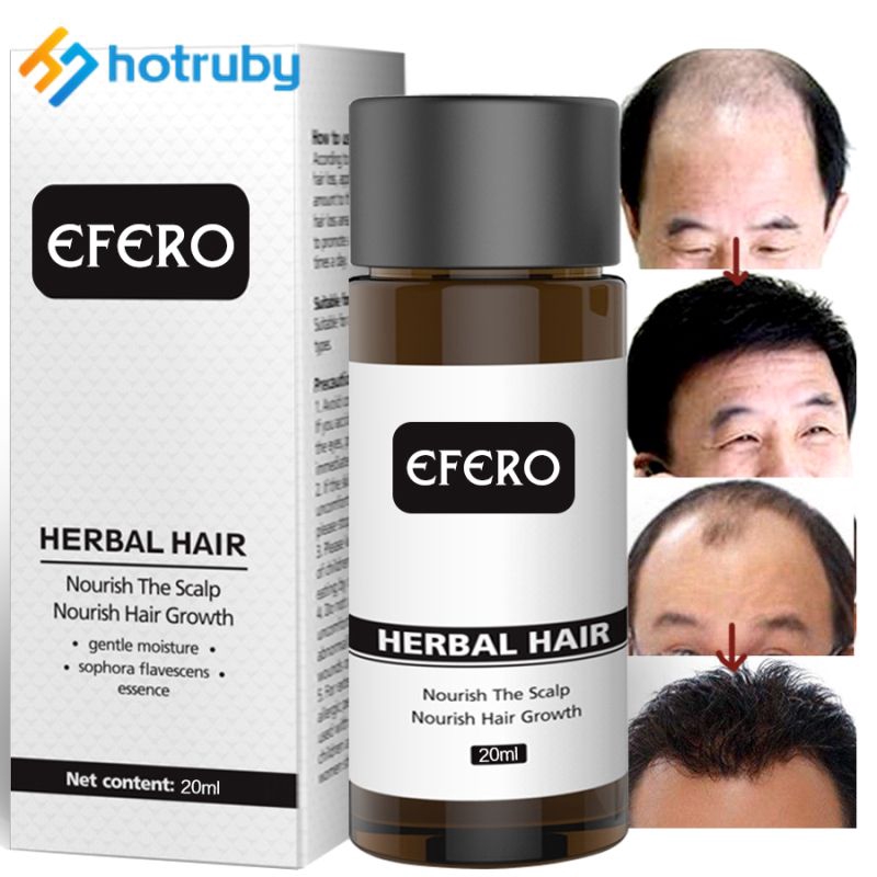 Hair Loss Serum Dense Hair Growth Serum Prevent Baldness Anti Hair