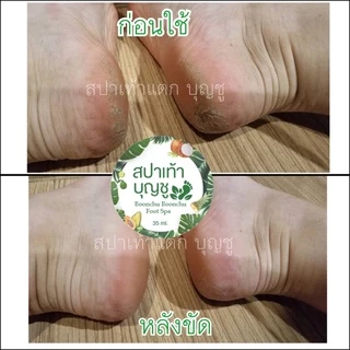 สปาขัดเท้าแตก สปาเท้าบุญชู(อุปกรณ์ครบใน1ชุด)ขัดส้นเท้าแตก เห็นผลตั้งแต่ครั้งแรกที่ใช้ ของแท้ 100% (คลิกดูรีวิว)