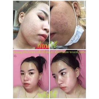 ค่าส่งถูก สบู่โสมนางฟ้า โฉมใหม่ รุ่นดั้งเดิม ของแท้ 100% โสมนางฟ้า สบู่ บำรุงผิวหน้า