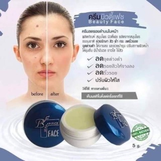 ครีมลดรอยดำ บิวตี้เฟส Beauty Face ตลับนำ้เงิน 1 กล่อง