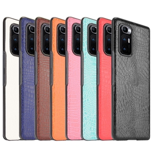 Xiaomi Mi Mix Fold Casing Fashion Crocodile Pattern Hard PC PU Leather Back Cover Hard Plastic Case เคสโทรศัพท์