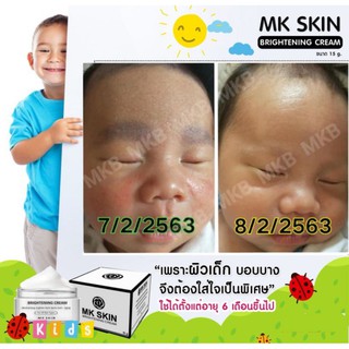 MKB KIDS SmileeE ครีมทาแก้ผื่นคันเด็ก ครีมทาแก้ผื่นผ้าอ้อม สำหรับเด็กและทารก ครีมทาแก้ผื่น ปลอดภัย เห็นผลในครั้งแรก แท้