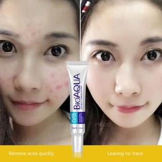 BIOAQUA ครีมแต้มสิว สิวและจุดด่างดำ แต้มสิวอักเสบ สลายสิวอุดตัน สิวยุบ แห้งเร็ว Skin Removal of Acne