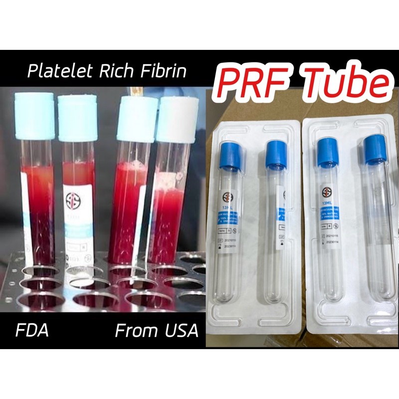 (แพคคู่)PRF Tube PRF หลอดเลือดสำหรับสกัด Platelet+Growth Factor+Rich Fibrin 1 แพคมี 2 หลอด