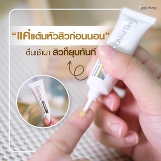 Welpano  Acne gel 10 กรัม เวลพาโน่ แต้มสิว (welpano) ไม่ทิ้งรอยดำ