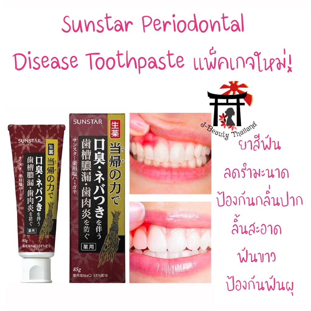 Sunstar Periodontal Disease Toothpasteยาสีฟันลดรำมะนาด ป้องกันกลิ่นปาก ลิ้นสะอาด ฟันขาว ป้องกันฟันผุ