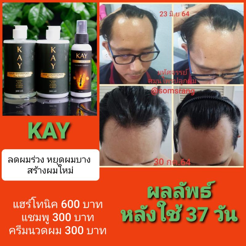 ชุดผม KAY Miracle Hair TonicHair ShampooHair Conditioner มหัศจรรย์ ...