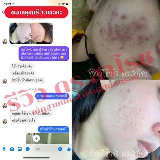 DR.SAROJ(ของแท้) ดร.สาโรช (Dr.Saroj) โลชั่นรักษาสิว สำหรับสิวอุดตัน (ทาทั่วหน้า) 60 ml.