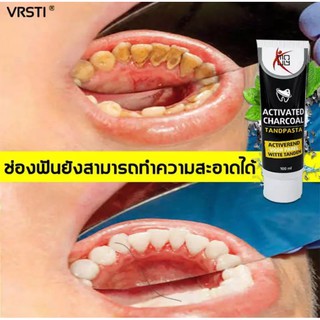 ยาสีฟันชาโค100ml vrsti ยาสีฟันฟอกฟันขาว ถ่านไม้ไผ่ดัตช์ ขจัดกลิ่นปาก แก้ปวดฟัน ฟอกสีฟันยาสีฟันถ่านไม้ไผ่-5230