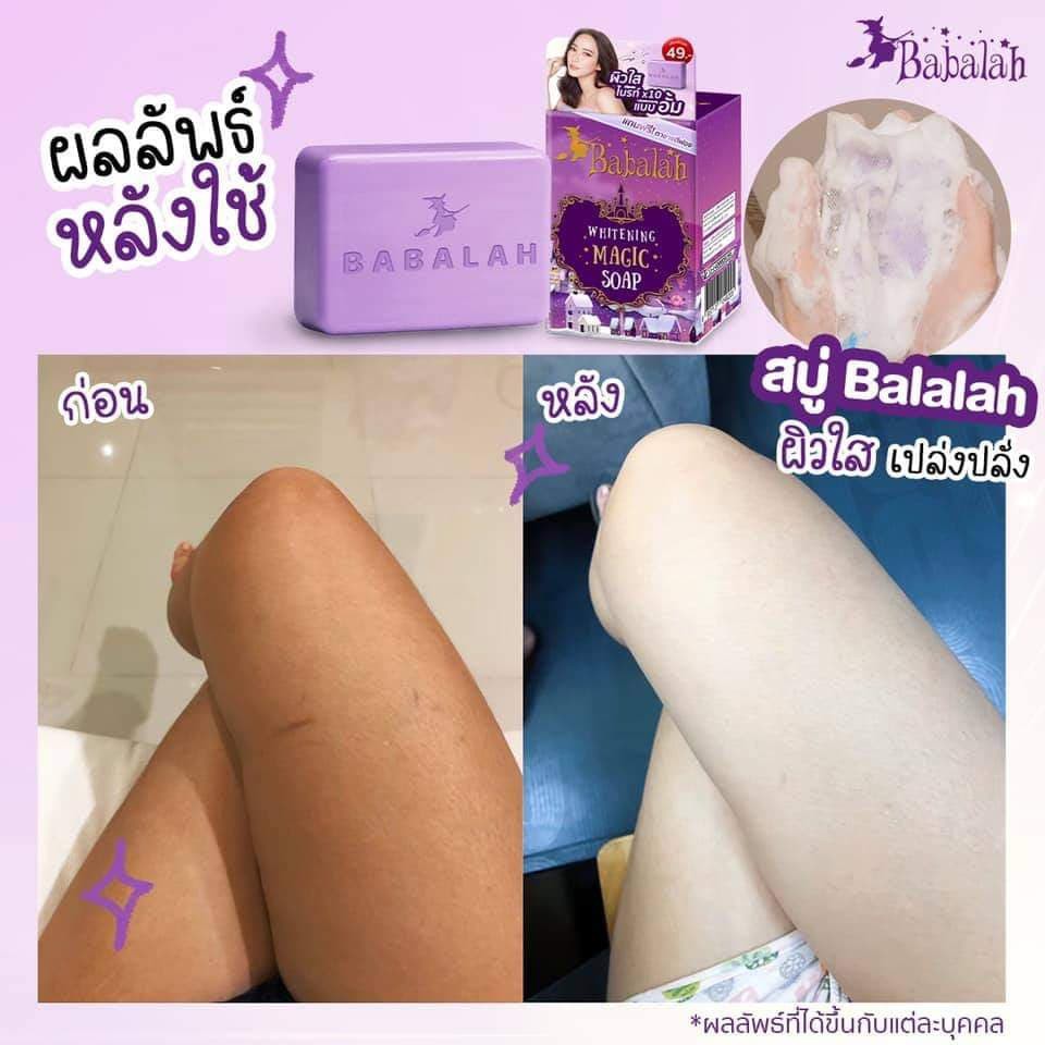 สบู่บาบาร่า Babalah Whitening Magic Soap สบู่ตัวขาว สบู่ babalah สบู่ขัดตัว  สบู่บาบาล่า สบู่อั้ม สบู่ บาบาร่า สบู่babala | Shopee Thailand