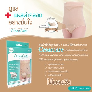 CESARCARE  กางเกงชั้นในสำหรับคุณแม่ผ่าคลอด ช่วยเร่งการสมานแผล ลดอาการบวมแดง/คันและลดรอยแผลเป็น