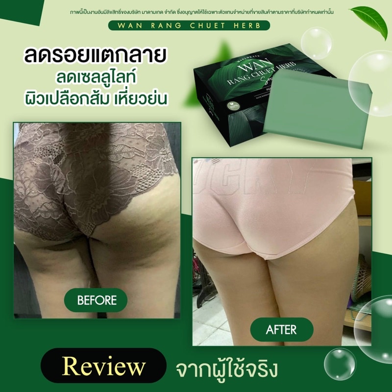 ส่งฟรี สบู่สมุนไพรว่านรางจืด สารสกัดว่านหางจระเข้ แก้สะเก็ดเงิน อาการคันตามผิวหนัง สบู่รักษาโรคผิวหนัง กลาก เกลื้อน ราคา ถูกที่สุด ดีลบีเคเค แกลเลอรีภาพที่ 9