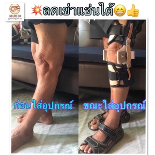 💥เยี่ยม👍อุปกรณ์ป้องกันข้อเข่าแอ่น(Anti-knee hyperextension)ลดเข่าแอ่นผู้ป่วยอัมพฤษ อัมพาต ช่วยยืน ช่วยเดิน