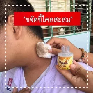 💥โทนเนอร์เช็ดคอดำ (❤️💜ยิ่งซื้อยิ่งลด)​ระเบิดขี้ไคล💥รักแร้ดำ💥ขาหนีบ💥ท้องดำ💥คราบไคลสะสม ขี้ไคลฝังลึก สิว