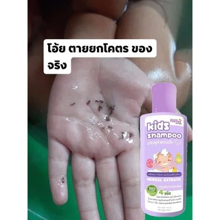 แชมพูเหาและหวีสางสแตนเลส สูตรสมุนไพร อ่อนโยน แชมพูเหาเด็ก 1ขวบใช้ได้