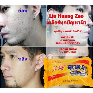 Clear skin Acne soap สบู่สิว  85กรัม สบู่ขิงกรัมมาถัน เคลียร์ทุกปัญหาผิวหน้า และร่างกาย เห็นผลตั้งแต่ก้อนแรก