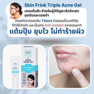 SkinFrink Triple AcneGelครีมลดปัญหาสิวอุดตันรอยดำผลัดเซลล์ผิวคุมมันสำหรับผิวช่วยแอนตี้แบคทีเรียที่ทำให้เกิดสิว(ครีมลดผิว